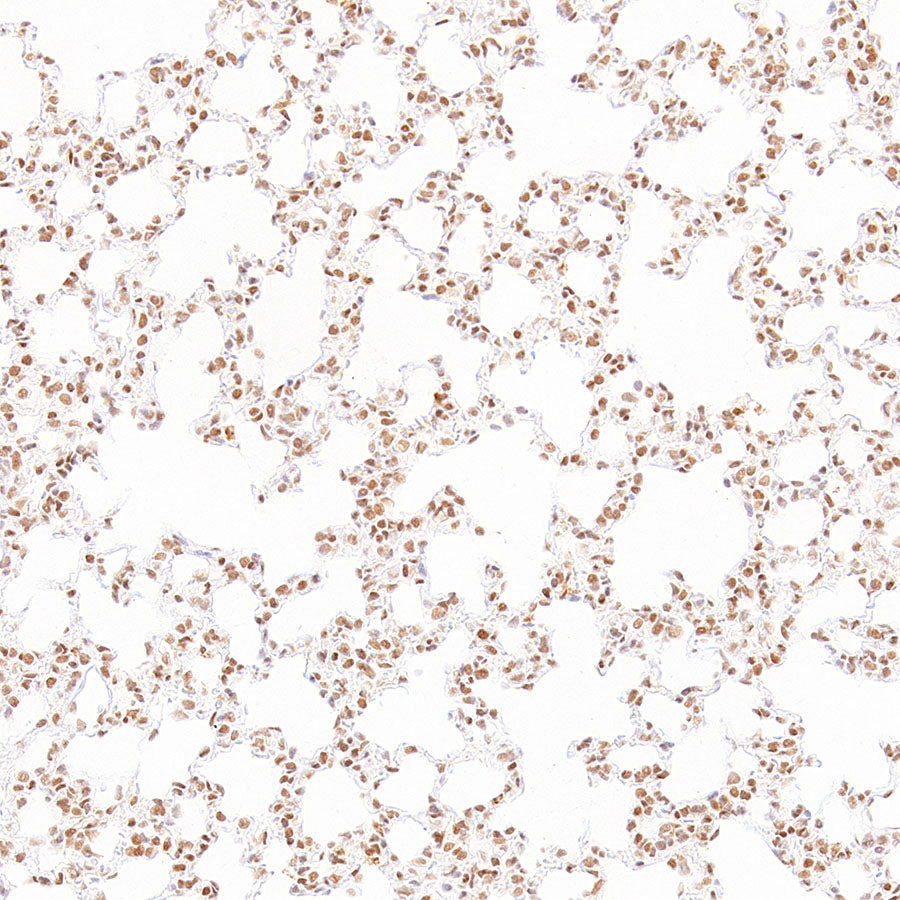 RAD21 Recombinant Rabbit mAb (S-4271-136)