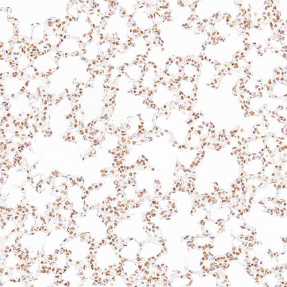 RAD21 Recombinant Rabbit mAb (S-4271-136)