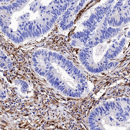 Galectin-1/LGALS1 Rabbit Polyclonal Antibody