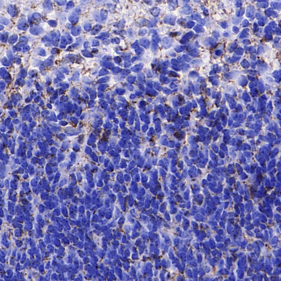 Nestin Recombinant Rabbit mAb (S-5471)