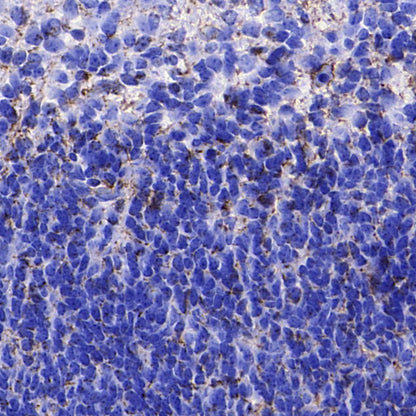Nestin Recombinant Rabbit mAb (S-5471)