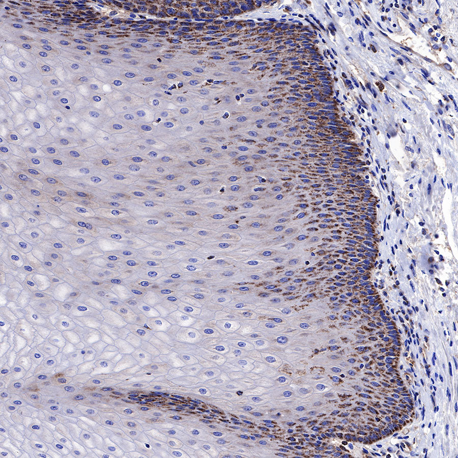 BAX Recombinant Rabbit mAb (SDT-338-76)