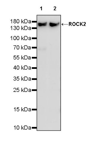 ROCK2 Rabbit Polyclonal Antibody