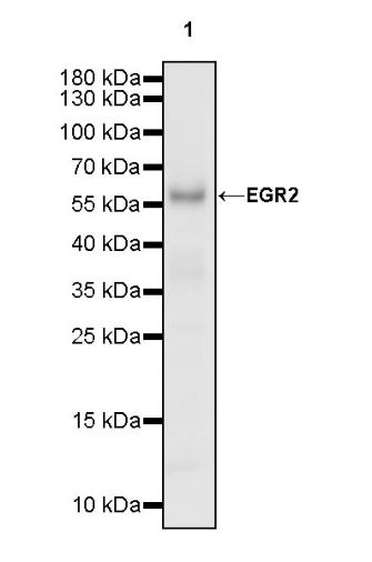 EGR2 Recombinant Rabbit mAb (S-741-136)