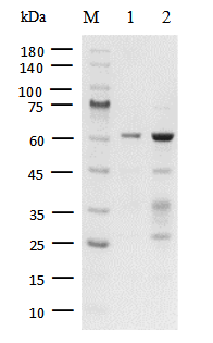 ANDR(LBD) Protein, Human
