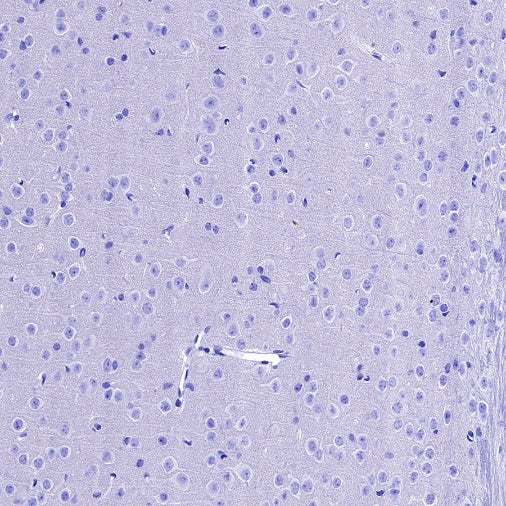 MYO7A Recombinant Rabbit mAb (S-2284-21)