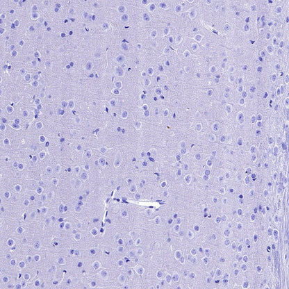 MYO7A Recombinant Rabbit mAb (S-2284-21)