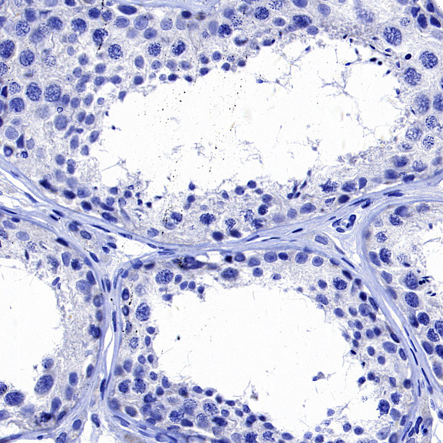 Hepatocyte Specific Antigen Recombinant Mouse mAb (SDT-4389)