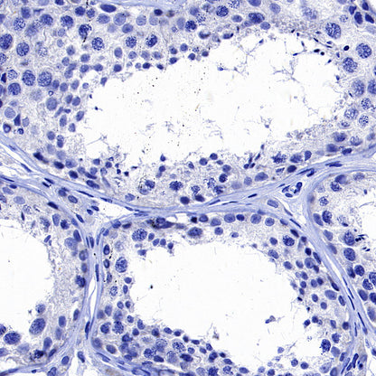 Hepatocyte Specific Antigen Recombinant Mouse mAb (SDT-4389)