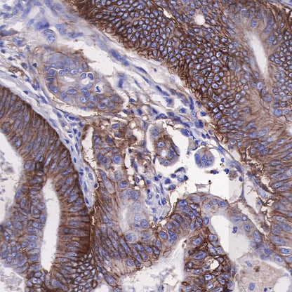 CD49b / Integrin alpha 2 Recombinant Rabbit mAb (SDT-399-52)