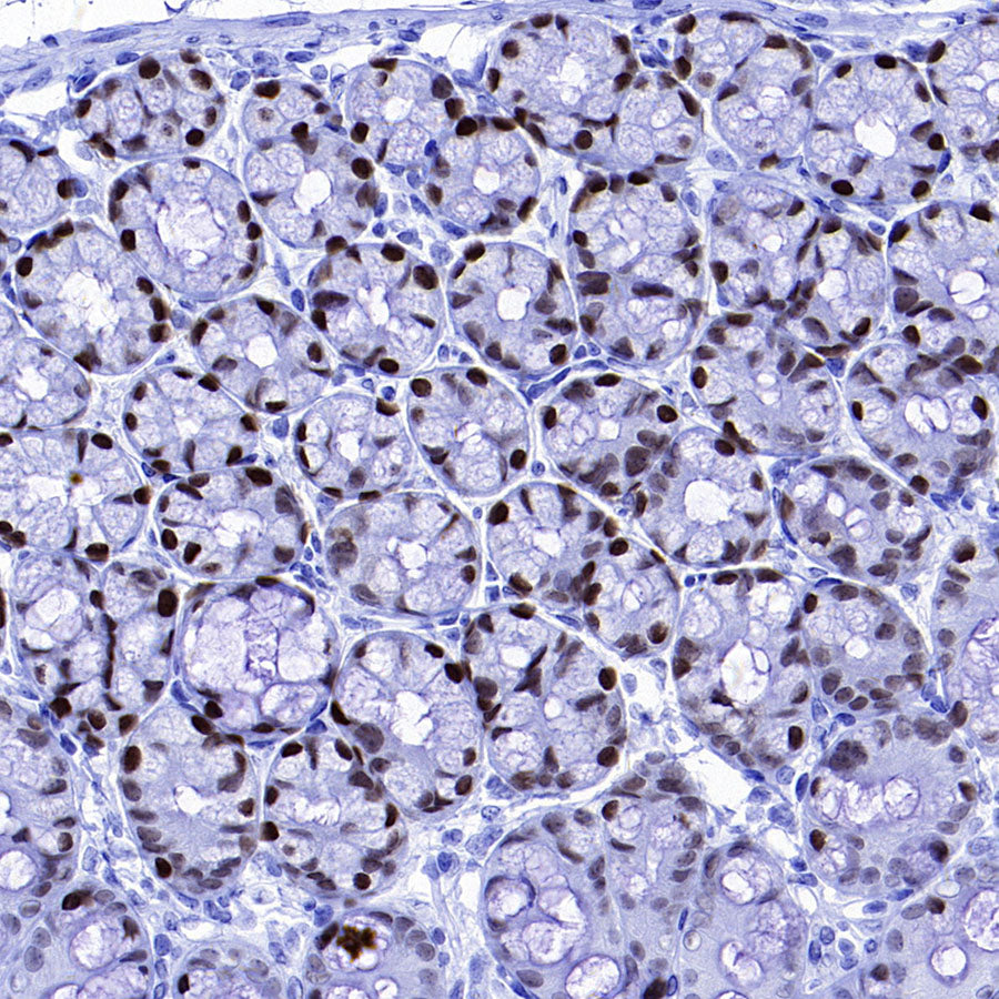 FOXA1 Recombinant Rabbit mAb (S-4339)