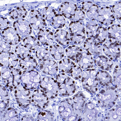 FOXA1 Recombinant Rabbit mAb (S-4339)