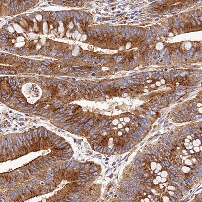Clathrin heavy chain Recombinant Rabbit mAb (S-1690-25)