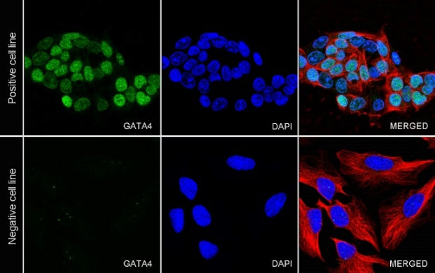 GATA4 Recombinant Rabbit mAb (S-1428-141)
