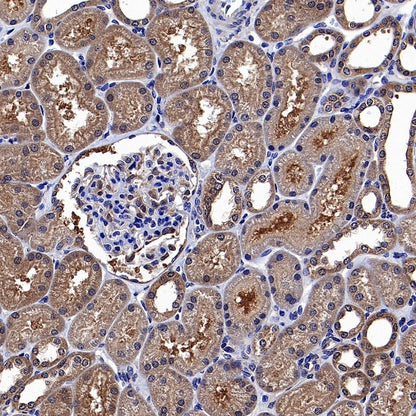Park7/DJ-1 Recombinant Rabbit mAb (S-980-144)
