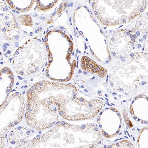 DLST Rabbit Polyclonal Antibody