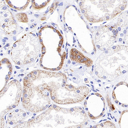 DLST Rabbit Polyclonal Antibody