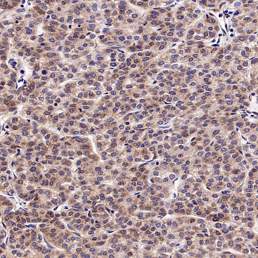 Argonaute 2 Recombinant Rabbit mAb (S-2620-13)