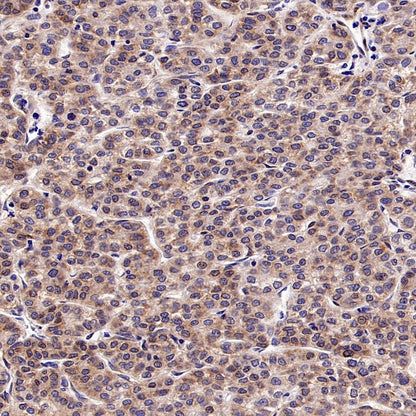 Argonaute 2 Recombinant Rabbit mAb (S-2620-13)