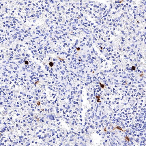 ALOX15 Recombinant Rabbit mAb (S-669-56)
