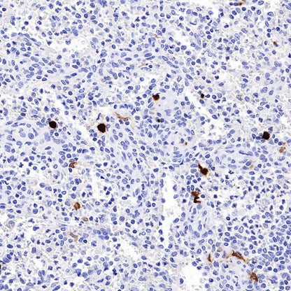 ALOX15 Recombinant Rabbit mAb (S-669-56)