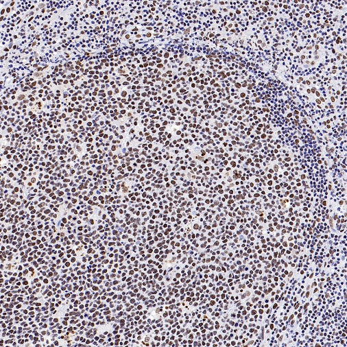 SIRT1 Recombinant Rabbit mAb (S-1886-15)