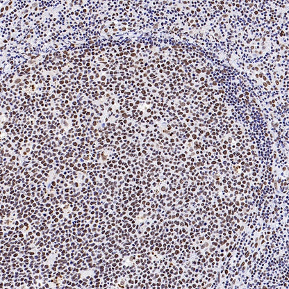 SIRT1 Recombinant Rabbit mAb (S-1886-15)