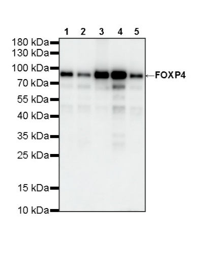 FOXP4 Recombinant Rabbit mAb (S-6198)