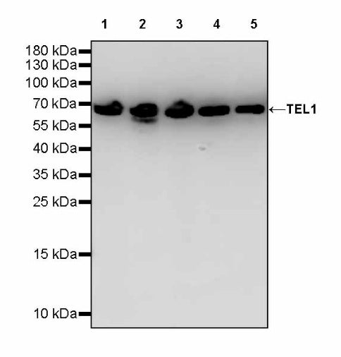 TEL1 Recombinant Rabbit mAb (S-3067-60)