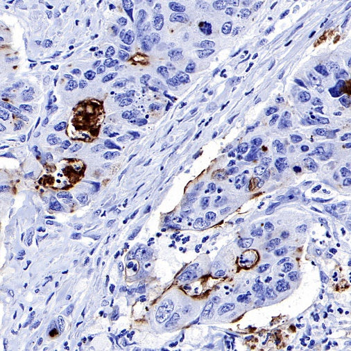 MUC1/EMA Mouse mAb (SDT-777-37)