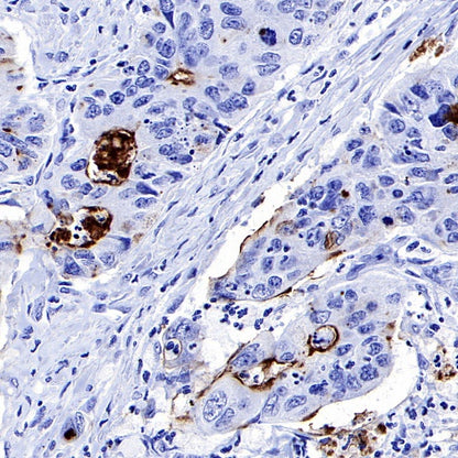 MUC1/EMA Mouse mAb (SDT-777-37)