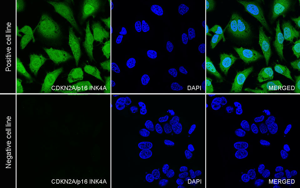 CDKN2A/p16 INK4A Recombinant Mouse mAb (Alexa Fluor® 488 Conjugate) (SDT-4675)