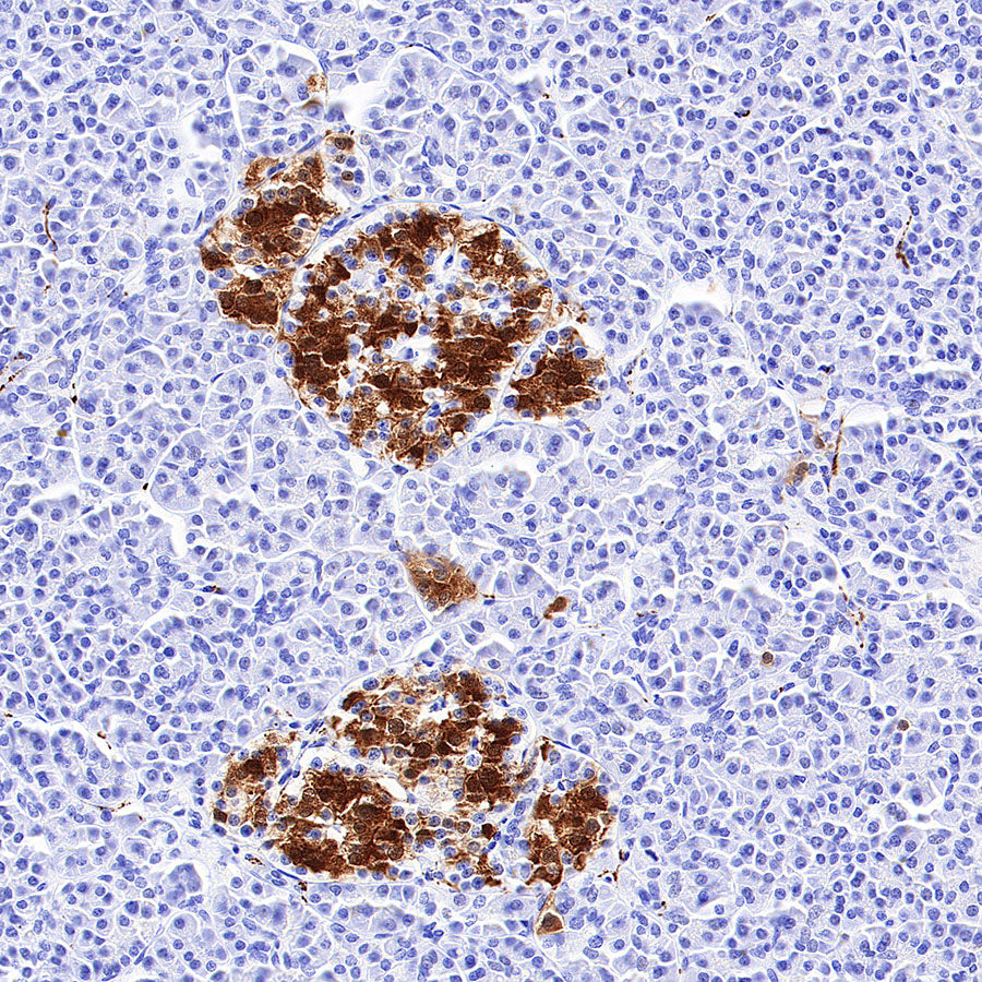PGP9.5 Recombinant Mouse mAb (S-6071)