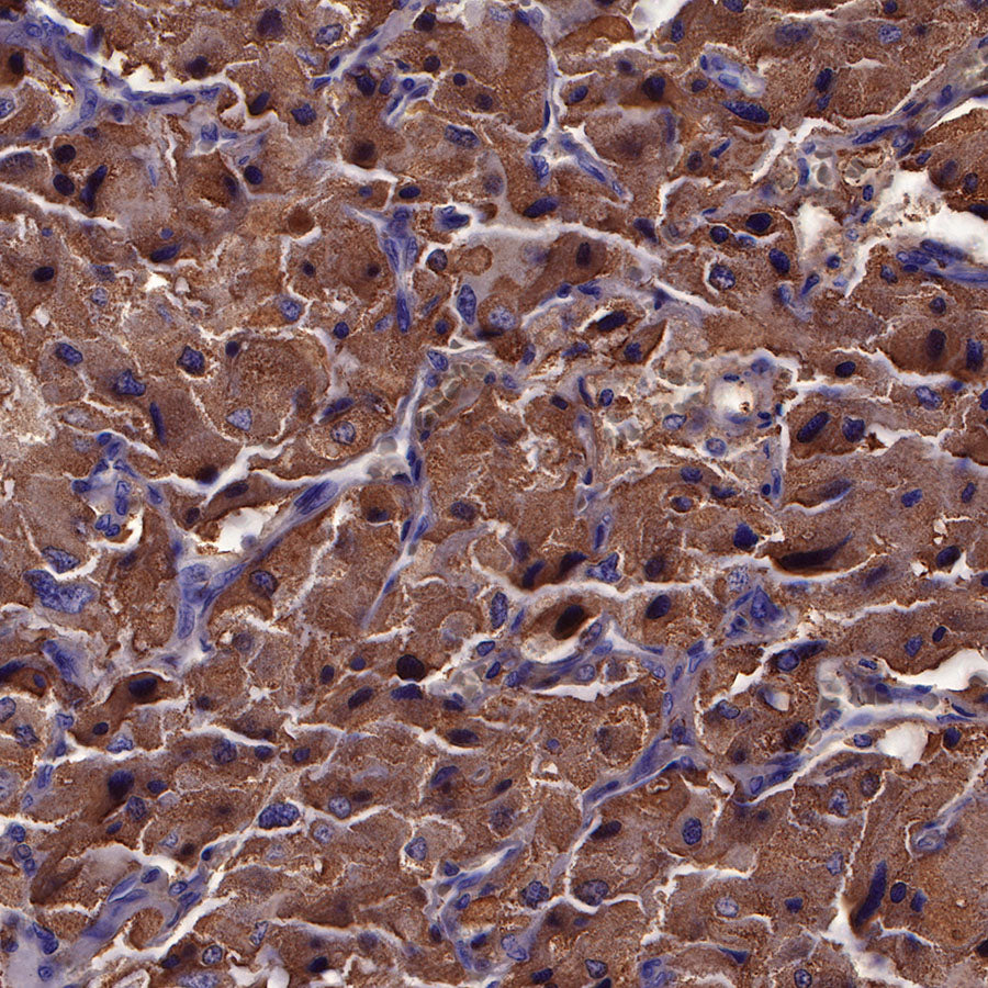 S-RMab® Chromogranin A Recombinant Rabbit mAb (SDT-074-57)