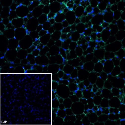UCP1 Recombinant Rabbit mAb (SDT-2275-37)