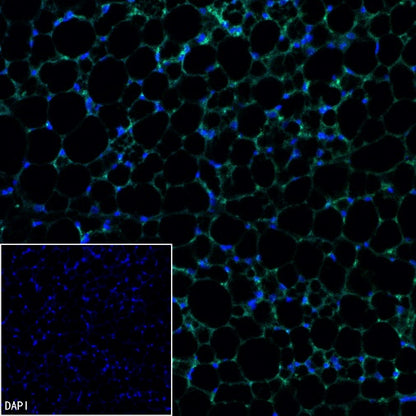 UCP1 Recombinant Rabbit mAb (SDT-2275-37)