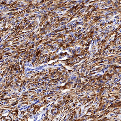 S-RMab® Factor XIIIa Recombinant Rabbit mAb (SDT-R278)