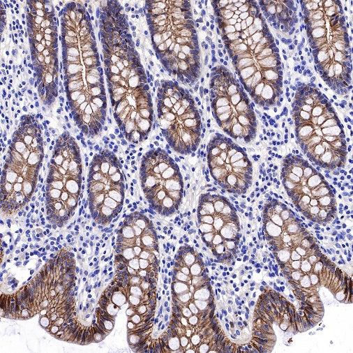 S-RMab® E-Cadherin Recombinant Rabbit mAb (SDT-438-5)