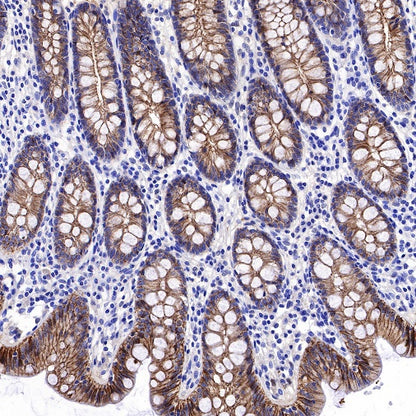 S-RMab® E-Cadherin Recombinant Rabbit mAb (SDT-438-5)