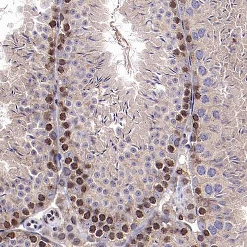 EGR1 Rabbit Polyclonal Antibody