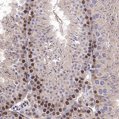 EGR1 Rabbit Polyclonal Antibody