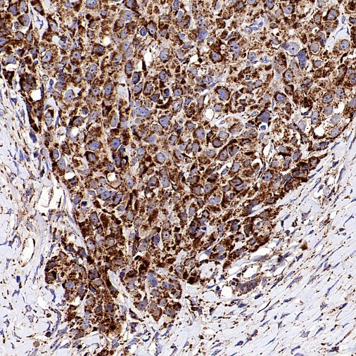 Fumarate hydratase Recombinant Rabbit mAb (SDT-2434-54)
