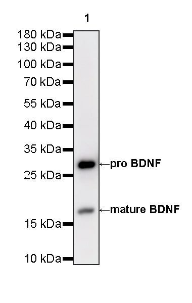 BDNF Recombinant Rabbit mAb (S-4118-38)