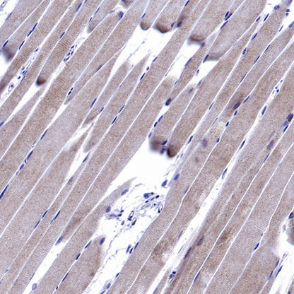 GABARAP Recombinant Rabbit mAb (S-2372-47)