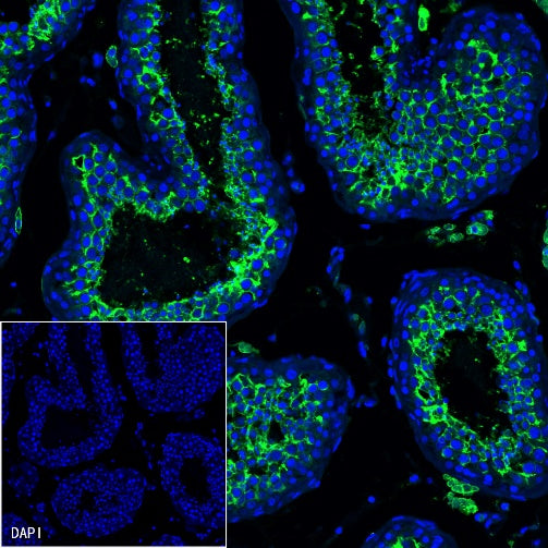 ACE2 Recombinant Rabbit mAb (S-1348-7)
