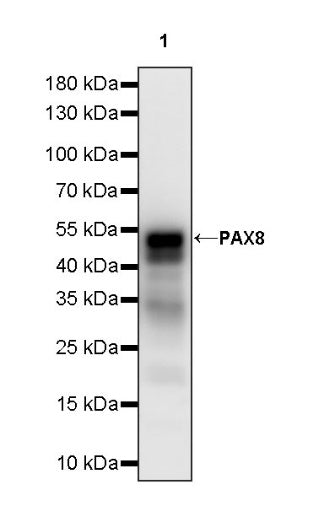 PAX8 Recombinant Rabbit mAb (SDT-R509)