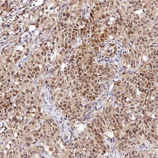 PBEF/Visfatin/NAMPT Rabbit Polyclonal Antibody