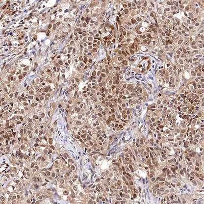PBEF/Visfatin/NAMPT Rabbit Polyclonal Antibody