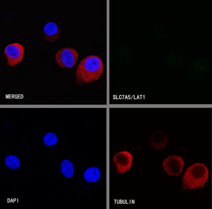 SLC7A5/LAT1 Recombinant Rabbit mAb (S-367-12)