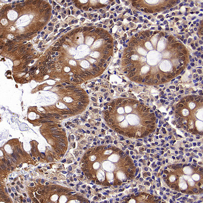 ACSS2 Recombinant Rabbit mAb (S-4117-9)